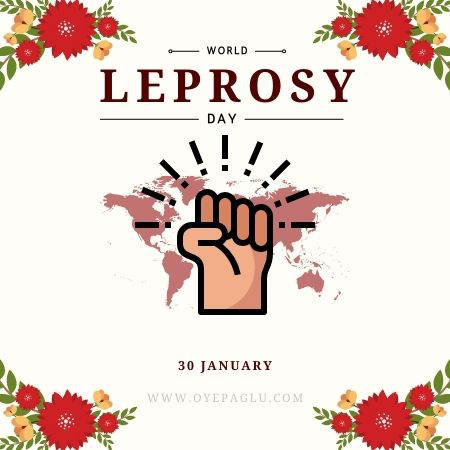 world leprosy day date